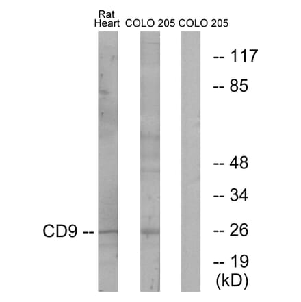 Western Blot - Anti-CD9 Antibody (C12162) - Antibodies.com