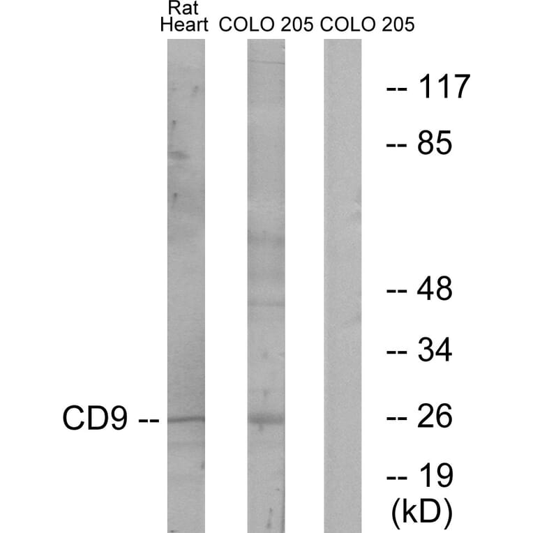 Western Blot - Anti-CD9 Antibody (C12162) - Antibodies.com