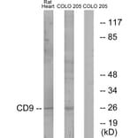 Western Blot - Anti-CD9 Antibody (C12162) - Antibodies.com