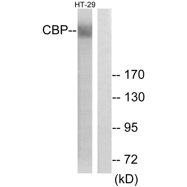 Western Blot - Anti-CBP Antibody (D0039) - Antibodies.com
