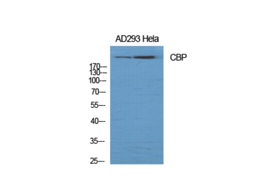 Western Blot - Anti-CBP Antibody (D0039) - Antibodies.com