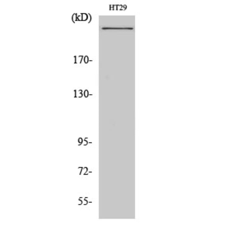 Western Blot - Anti-CBP Antibody (D0039) - Antibodies.com