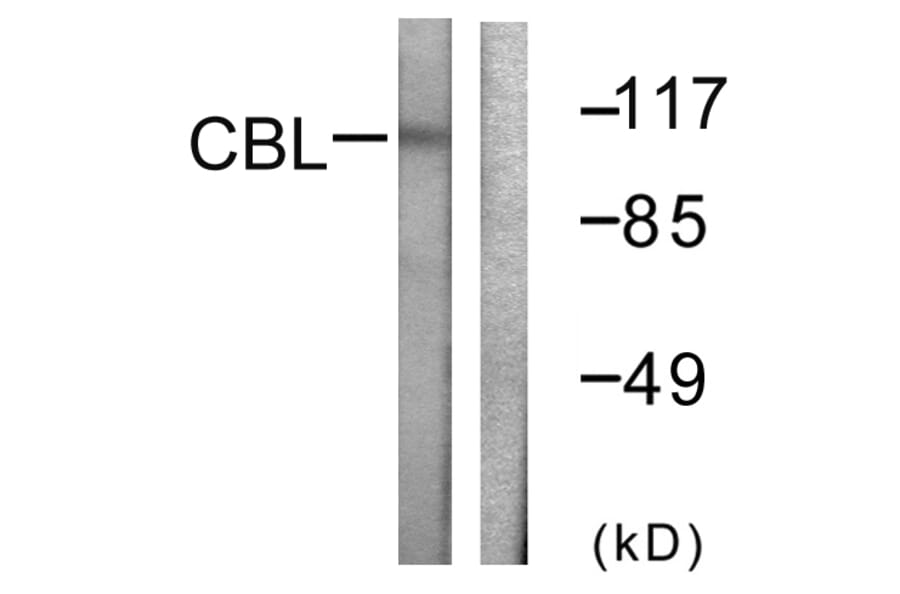 Western Blot - Anti-CBL Antibody (B0464) - Antibodies.com