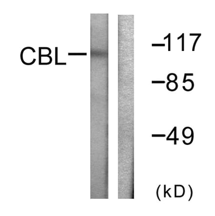 Western Blot - Anti-CBL Antibody (B0464) - Antibodies.com