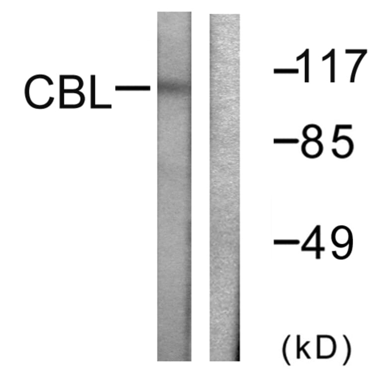 Western Blot - Anti-CBL Antibody (B0464) - Antibodies.com