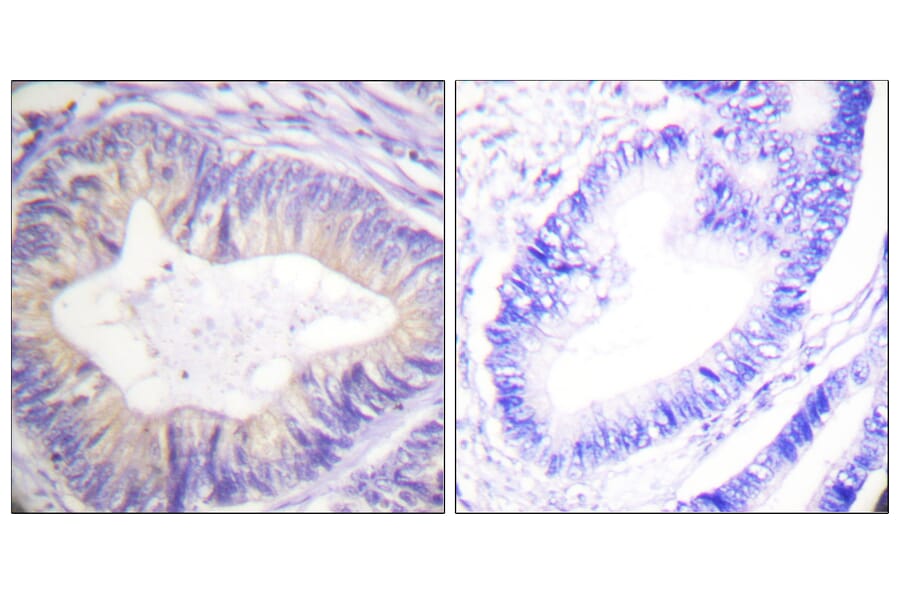 Immunohistochemistry - Anti-CBL Antibody (B0464) - Antibodies.com