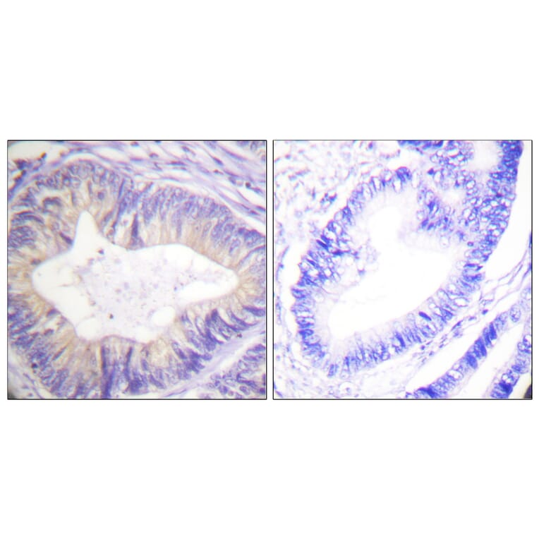 Immunohistochemistry - Anti-CBL Antibody (B0464) - Antibodies.com