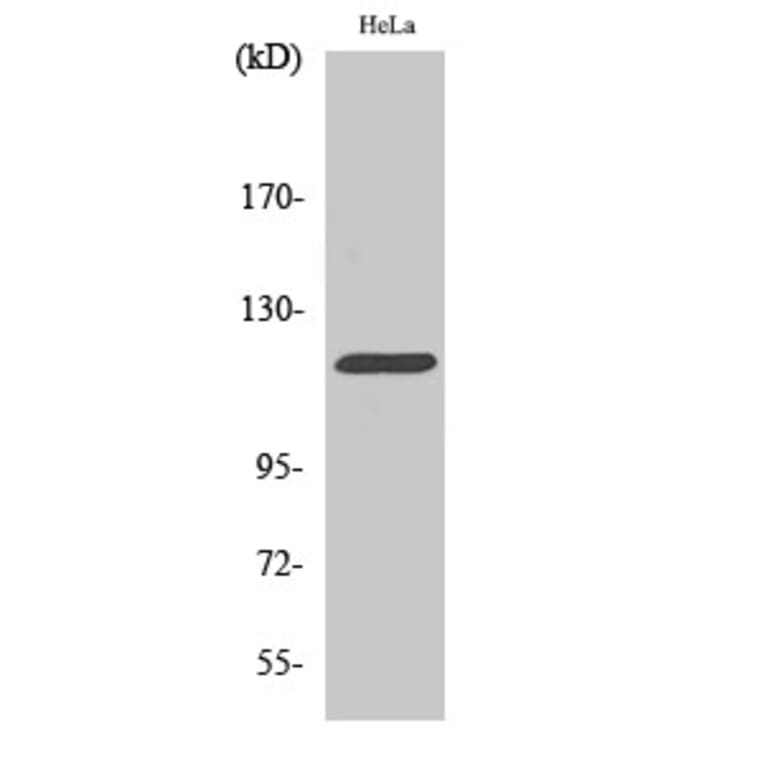 Western Blot - Anti-CBL Antibody (B0464) - Antibodies.com