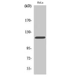 Western Blot - Anti-CBL Antibody (B0464) - Antibodies.com
