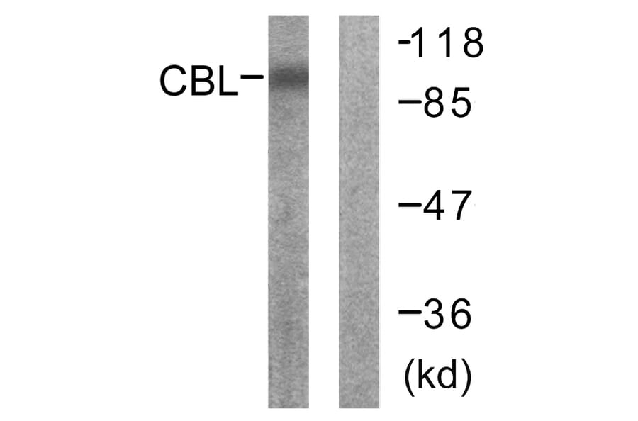 Western Blot - Anti-CBL Antibody (B0466) - Antibodies.com