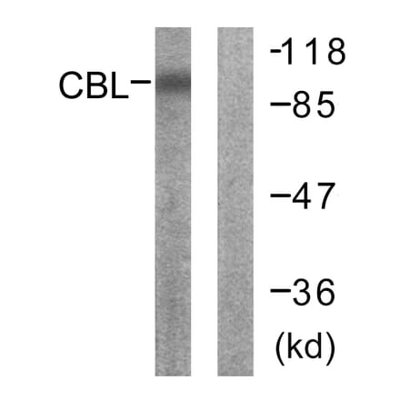 Western Blot - Anti-CBL Antibody (B0466) - Antibodies.com