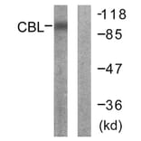 Western Blot - Anti-CBL Antibody (B0466) - Antibodies.com