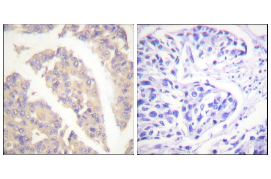 Immunohistochemistry - Anti-CBL Antibody (B0466) - Antibodies.com