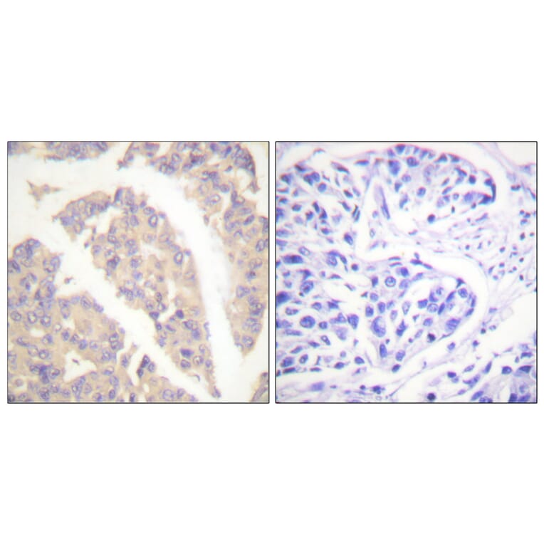 Immunohistochemistry - Anti-CBL Antibody (B0466) - Antibodies.com