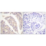 Immunohistochemistry - Anti-CBL Antibody (B0466) - Antibodies.com