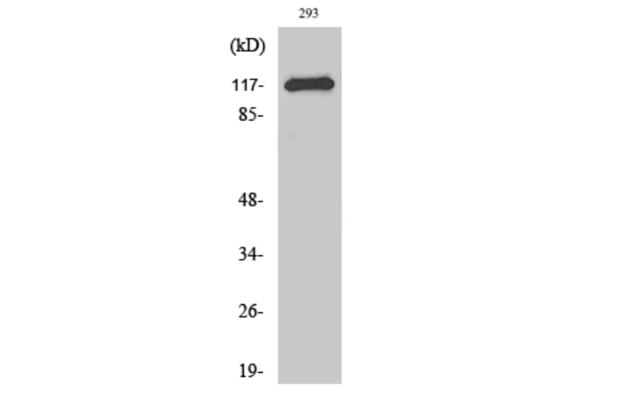 Western Blot - Anti-CBL Antibody (B0466) - Antibodies.com