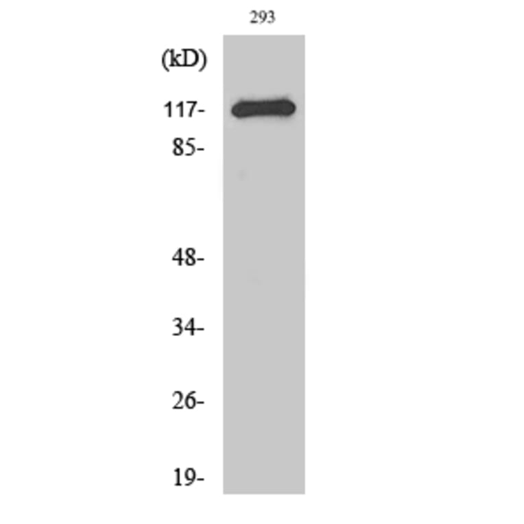 Western Blot - Anti-CBL Antibody (B0466) - Antibodies.com