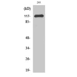 Western Blot - Anti-CBL Antibody (B0466) - Antibodies.com