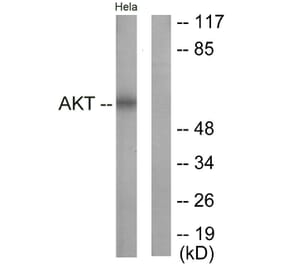 Western Blot - Anti-Akt Antibody (B0817) - Antibodies.com