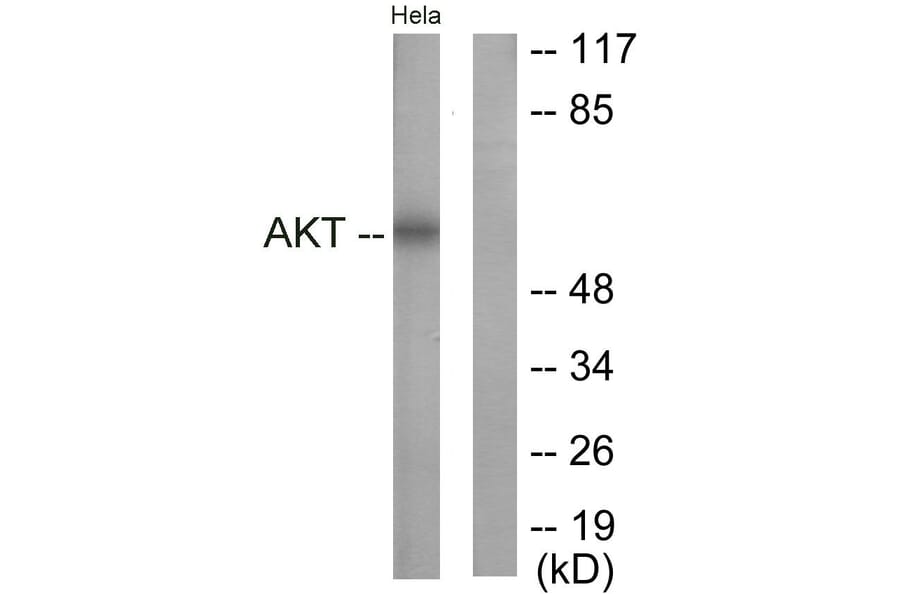 Anti-Akt Antibody (A95493) | Antibodies.com