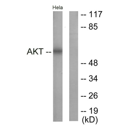 Western Blot - Anti-Akt Antibody (B0817) - Antibodies.com
