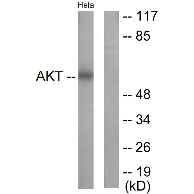 Western Blot - Anti-Akt Antibody (B0817) - Antibodies.com