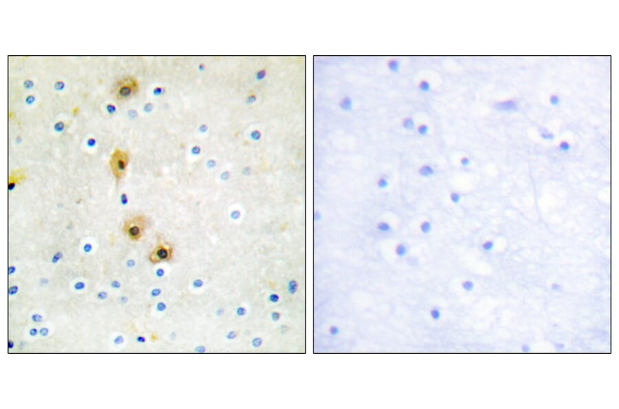 Immunohistochemistry - Anti-Akt Antibody (B0817) - Antibodies.com
