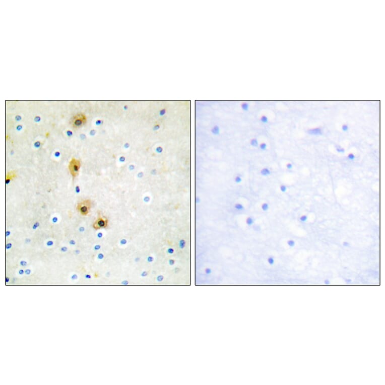 Immunohistochemistry - Anti-Akt Antibody (B0817) - Antibodies.com