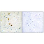 Immunohistochemistry - Anti-Akt Antibody (B0817) - Antibodies.com