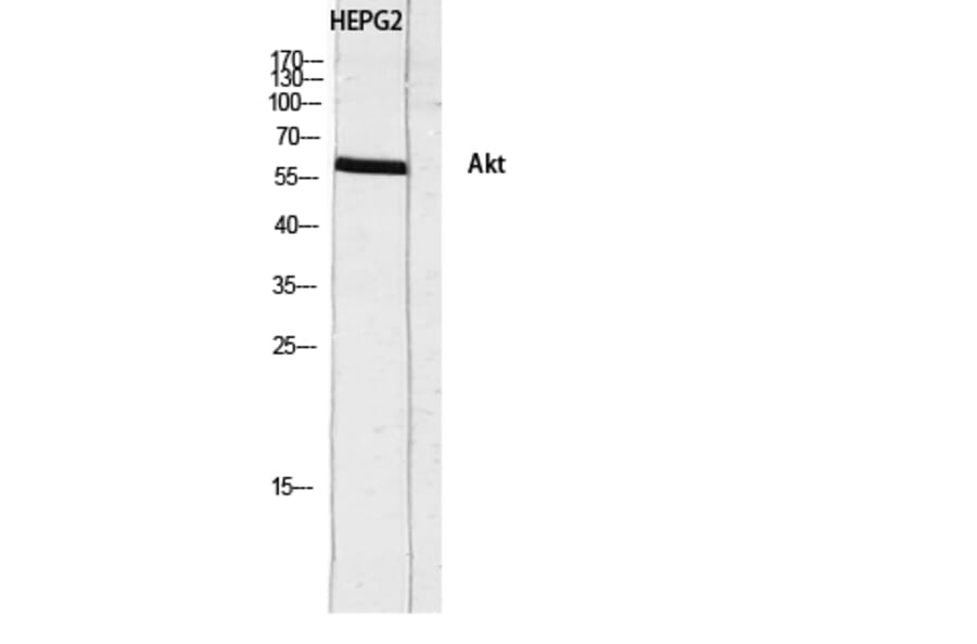 Western Blot - Anti-Akt Antibody (B0817) - Antibodies.com