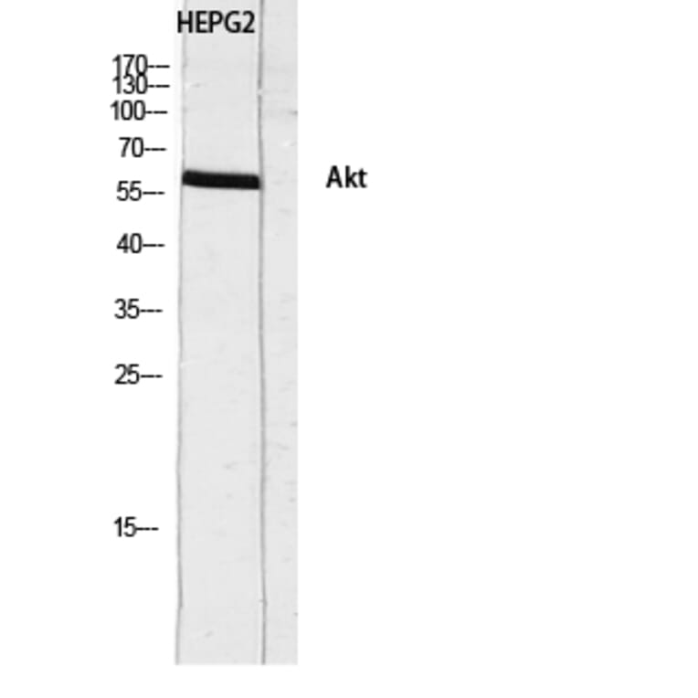 Western Blot - Anti-Akt Antibody (B0817) - Antibodies.com