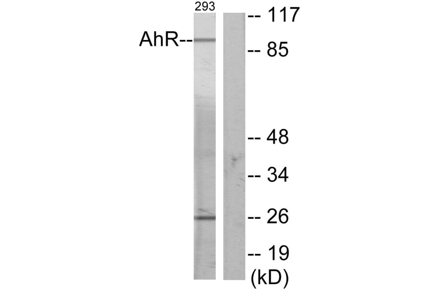 Western Blot - Anti-AhR Antibody (B0765) - Antibodies.com