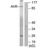 Western Blot - Anti-AhR Antibody (B0765) - Antibodies.com