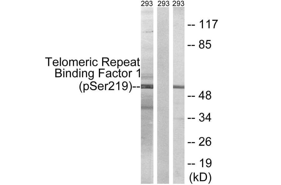 Western Blot - Anti-Telomeric Repeat Binding Factor 1 (phospho Ser219) Antibody (A1239) - Antibodies.com