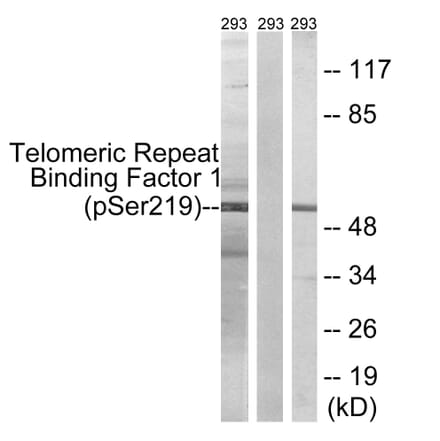 Western Blot - Anti-Telomeric Repeat Binding Factor 1 (phospho Ser219) Antibody (A1239) - Antibodies.com