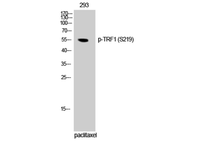 Western Blot - Anti-Telomeric Repeat Binding Factor 1 (phospho Ser219) Antibody (A1239) - Antibodies.com