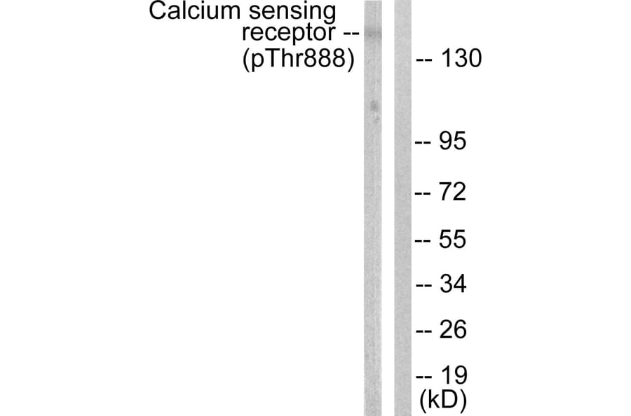 Western Blot - Anti-Calcium Sensing Receptor (phospho Thr888) Antibody (A0828) - Antibodies.com