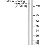 Western Blot - Anti-Calcium Sensing Receptor (phospho Thr888) Antibody (A0828) - Antibodies.com