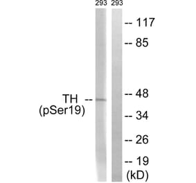 Western Blot - Anti-Tyrosine Hydroxylase (phospho Ser19) Antibody (A0037) - Antibodies.com