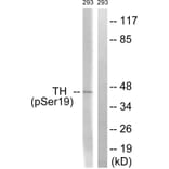 Western Blot - Anti-Tyrosine Hydroxylase (phospho Ser19) Antibody (A0037) - Antibodies.com