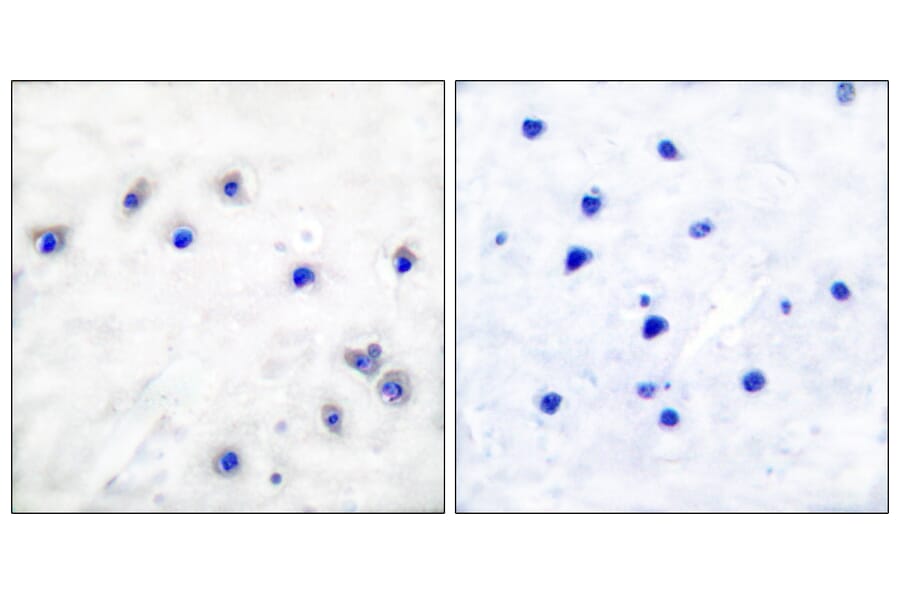 Immunohistochemistry - Anti-Tyrosine Hydroxylase (phospho Ser19) Antibody (A0037) - Antibodies.com