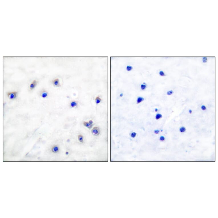 Immunohistochemistry - Anti-Tyrosine Hydroxylase (phospho Ser19) Antibody (A0037) - Antibodies.com