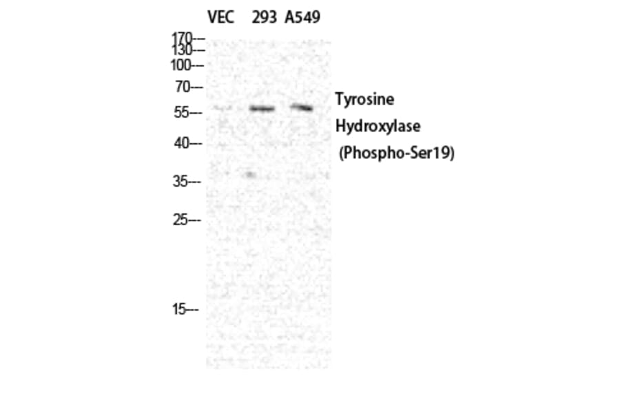 Western Blot - Anti-Tyrosine Hydroxylase (phospho Ser19) Antibody (A0037) - Antibodies.com