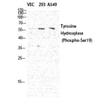 Western Blot - Anti-Tyrosine Hydroxylase (phospho Ser19) Antibody (A0037) - Antibodies.com