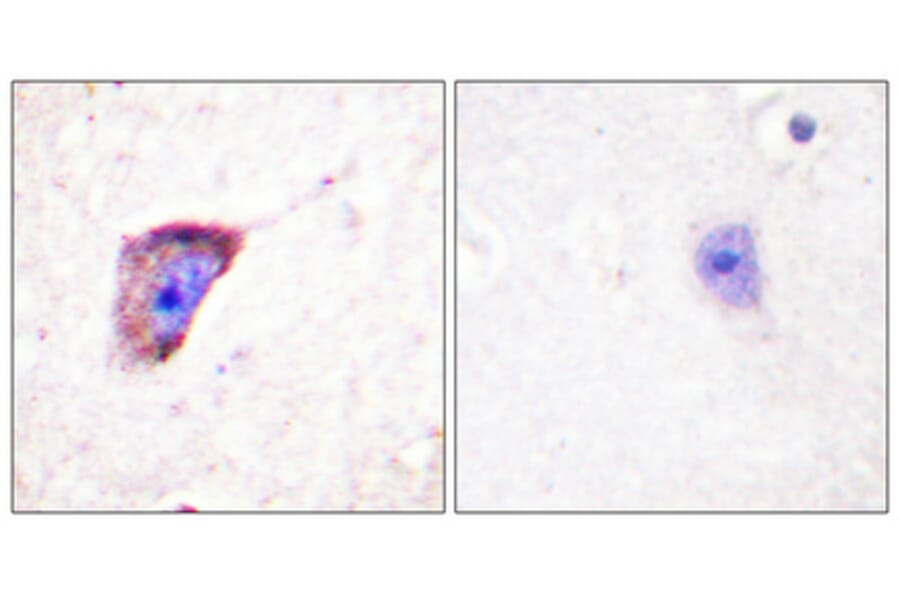 Immunohistochemistry - Anti-Tyrosine Hydroxylase (phospho Ser19) Antibody (A0037) - Antibodies.com
