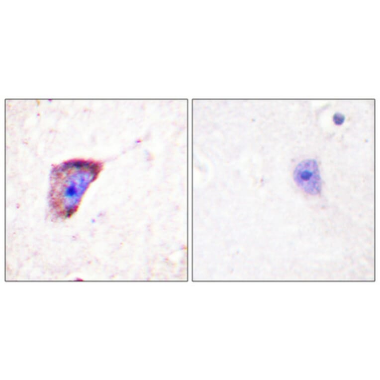 Immunohistochemistry - Anti-Tyrosine Hydroxylase (phospho Ser19) Antibody (A0037) - Antibodies.com