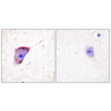 Immunohistochemistry - Anti-Tyrosine Hydroxylase (phospho Ser19) Antibody (A0037) - Antibodies.com