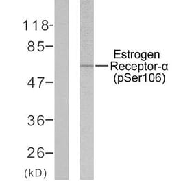 Western Blot - Anti-Estrogen Receptor-alpha (phospho Ser106) Antibody (A7076) - Antibodies.com