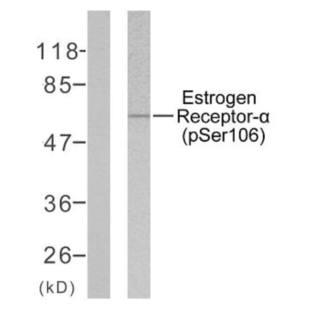 Western Blot - Anti-Estrogen Receptor-alpha (phospho Ser106) Antibody (A7076) - Antibodies.com