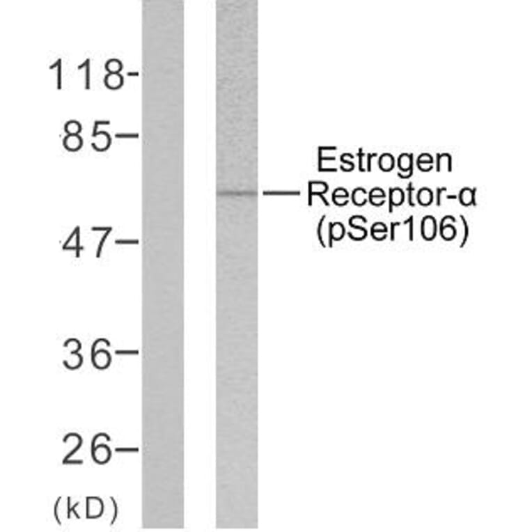 Western Blot - Anti-Estrogen Receptor-alpha (phospho Ser106) Antibody (A7076) - Antibodies.com